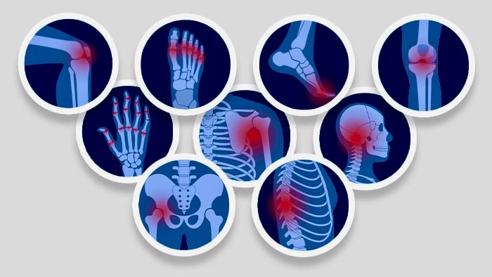 Pain Conditions